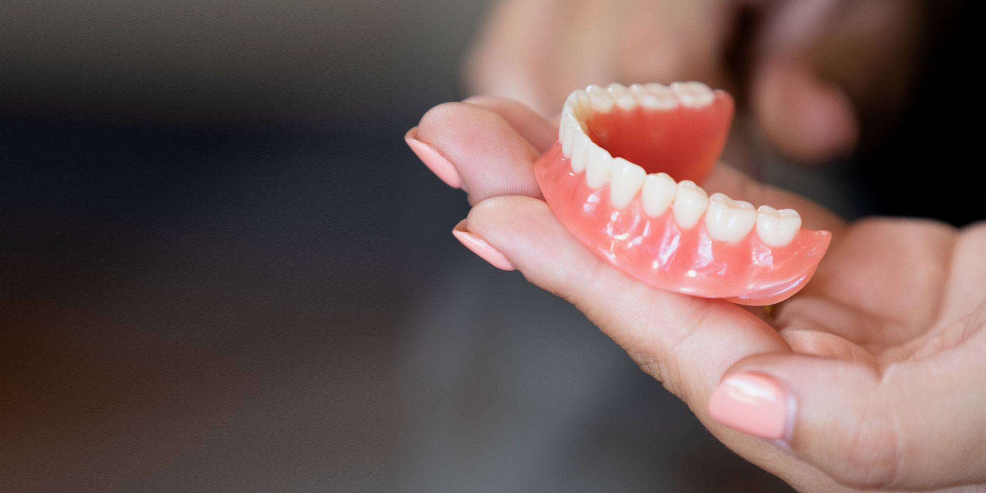 The Hidden Risks of Staying in Dentures Too Long (And Why Modern Alternatives Protect Your Health)