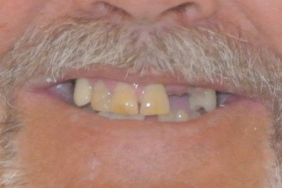 Before