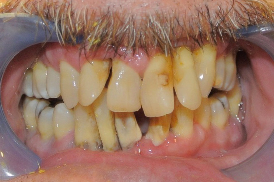 Before