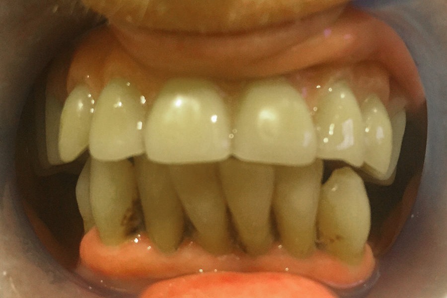 Before