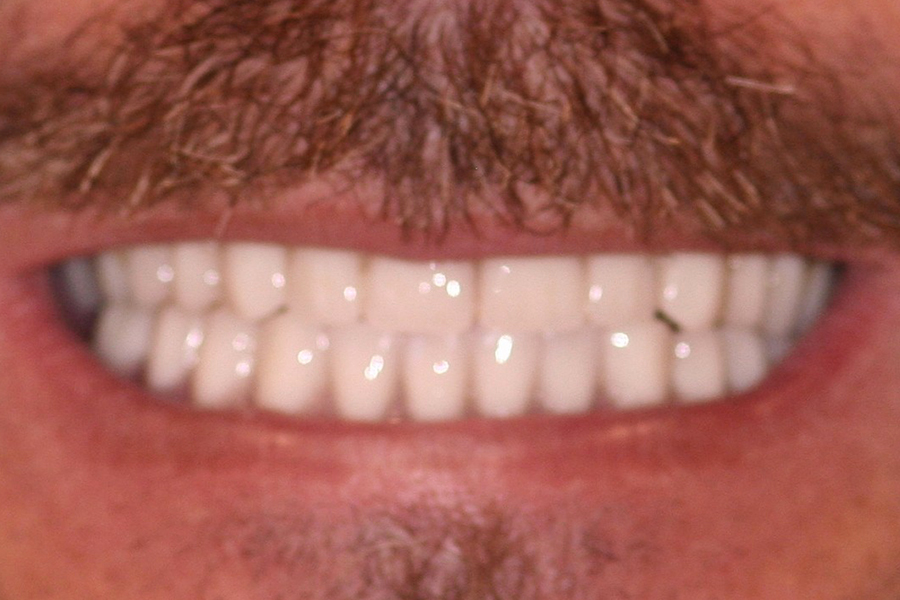 After