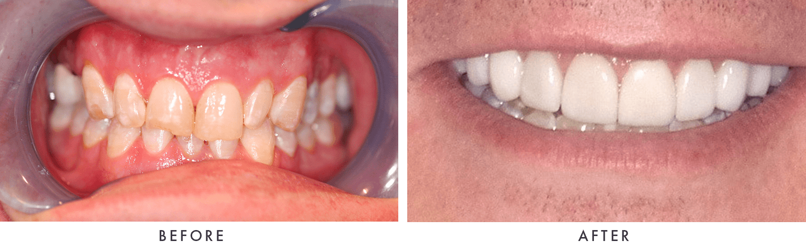 Patient Before And After Photos