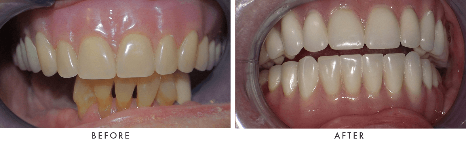 Patient Before And After Photos