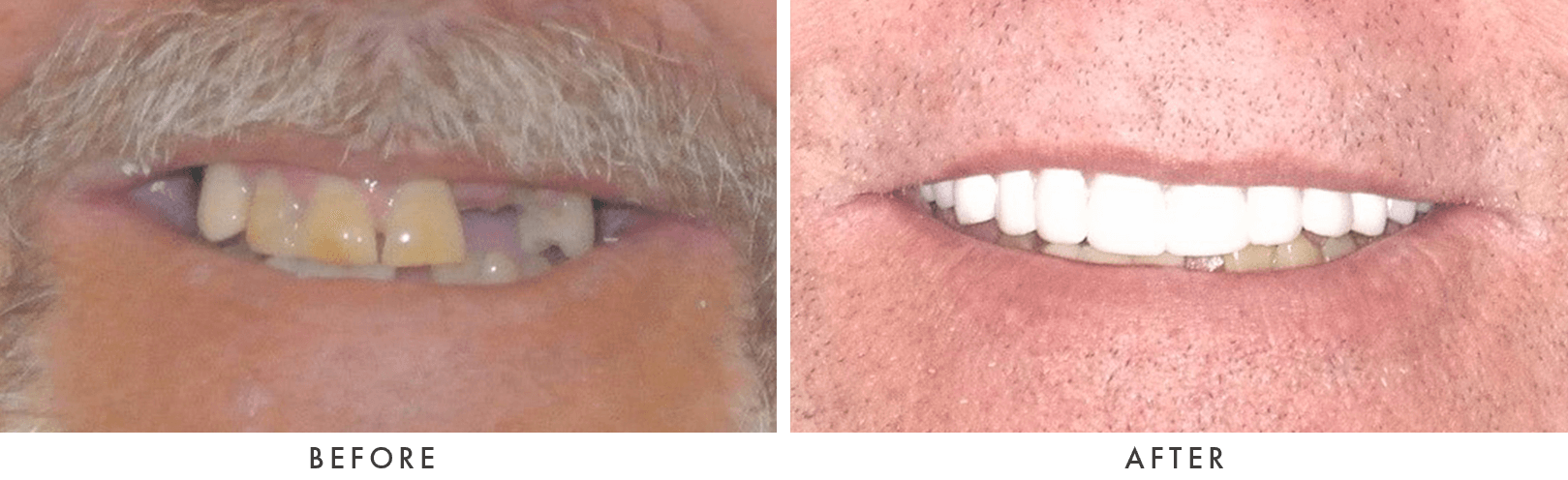 Patient Before And After Photos