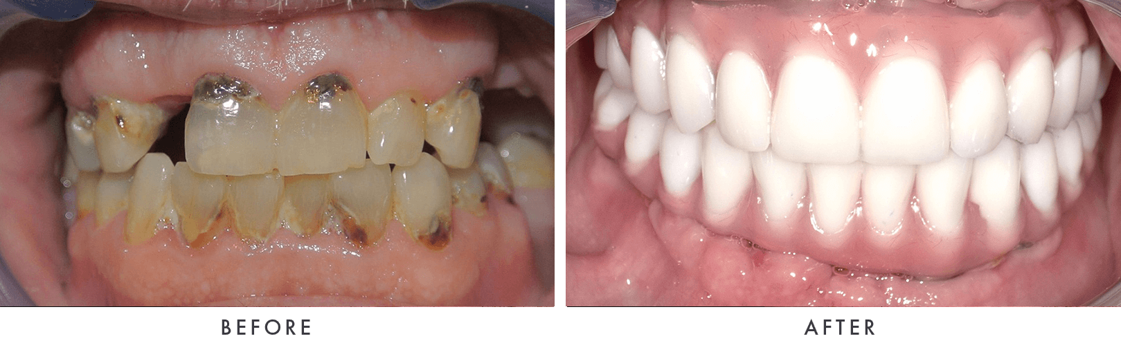 Patient Before And After Photos