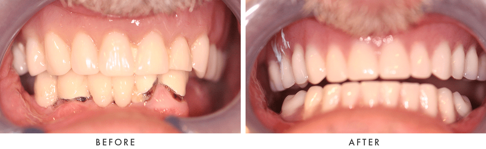 Patient Before And After Photos