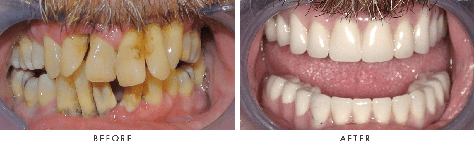 Patient Before And After Photos