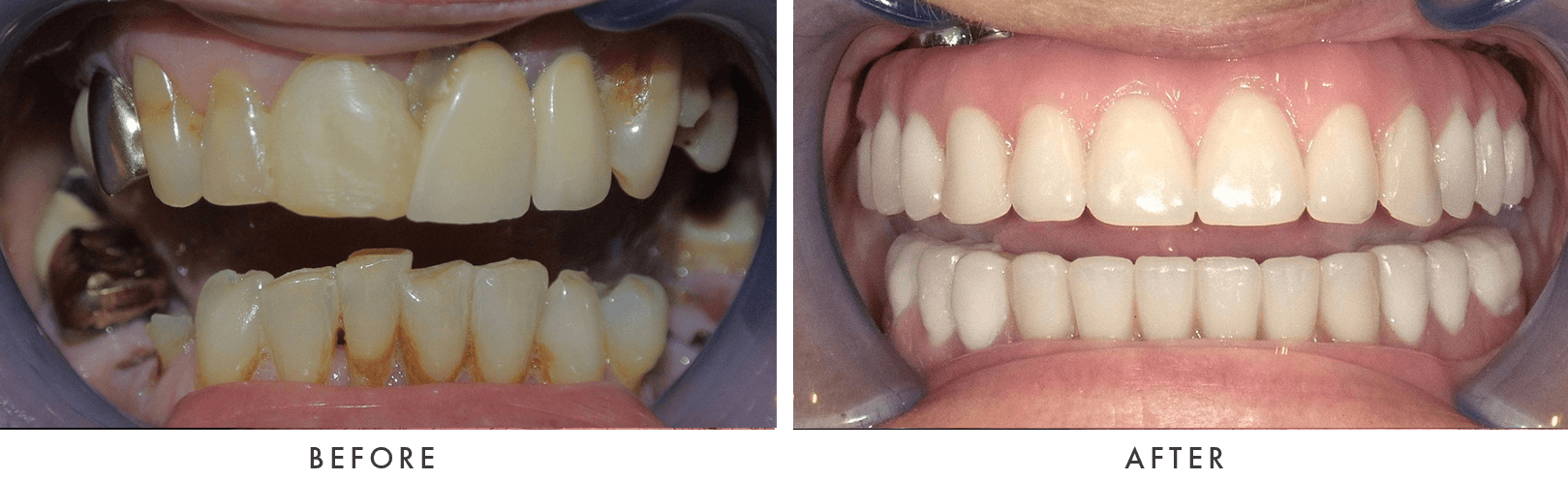 Patient Before And After Photos
