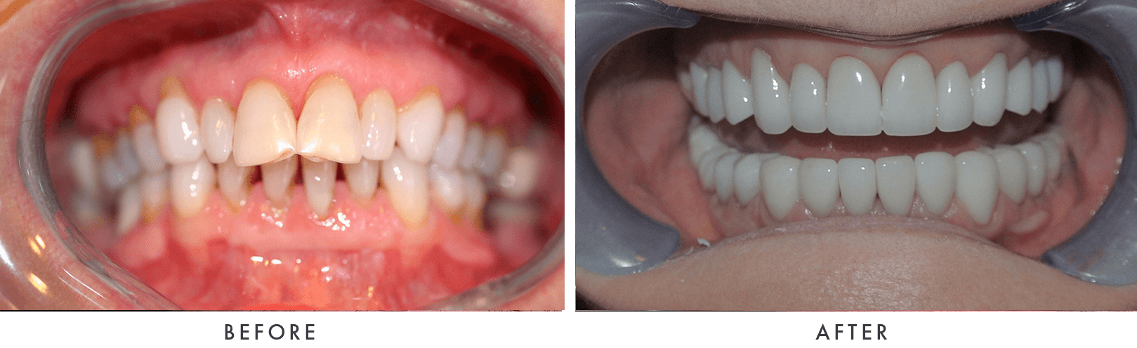 Patient Before And After Photos