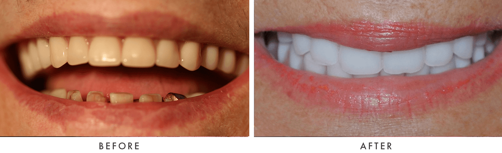 Patient Before And After Photos
