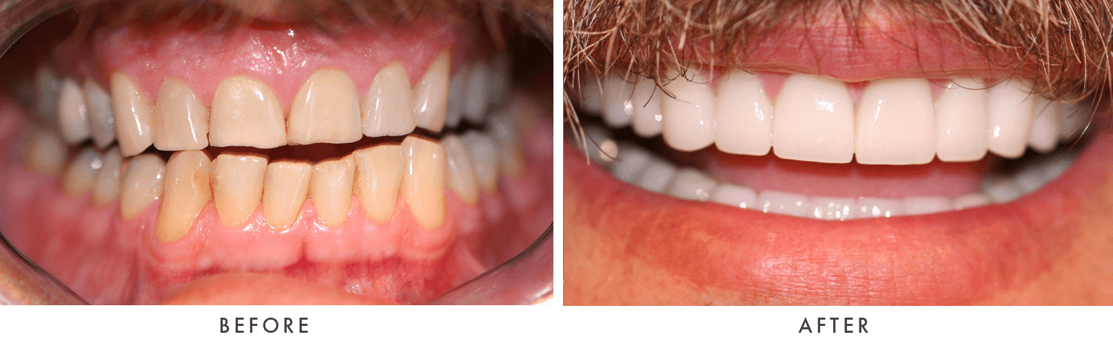 Patient Before And After Photos