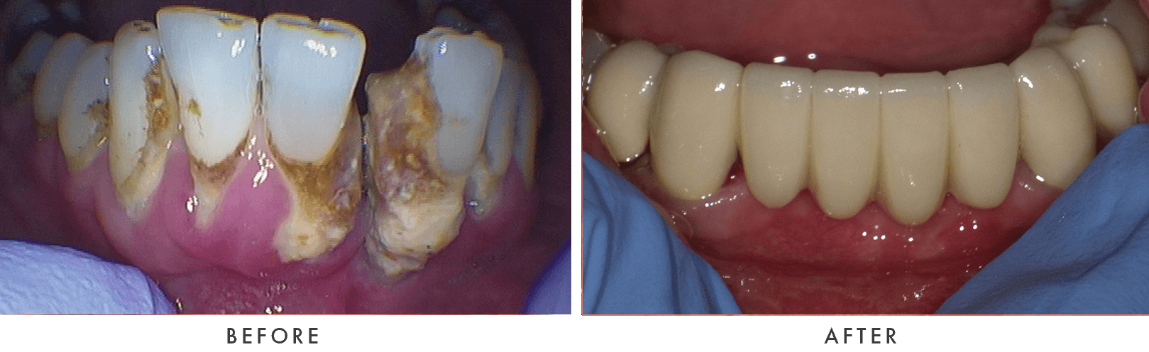 Patient Before And After Photos