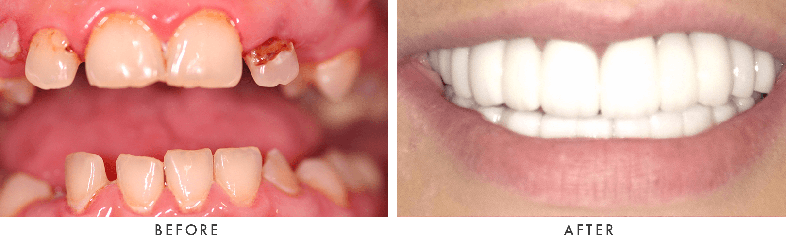 Patient Before And After Photos