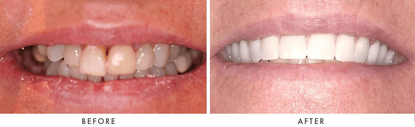 Patient Before And After Photos