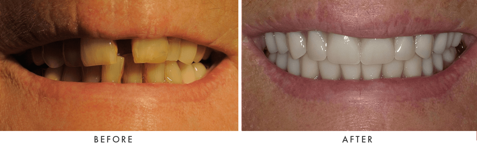 Patient Before And After Photos