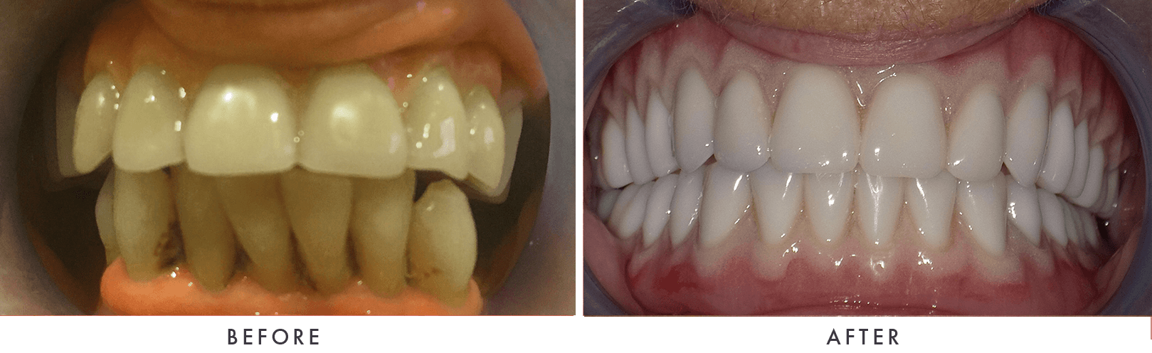 Patient Before And After Photos