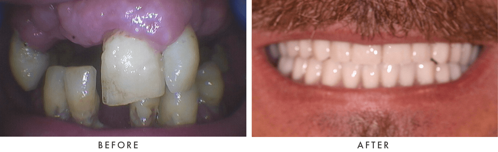 Patient Before And After Photos