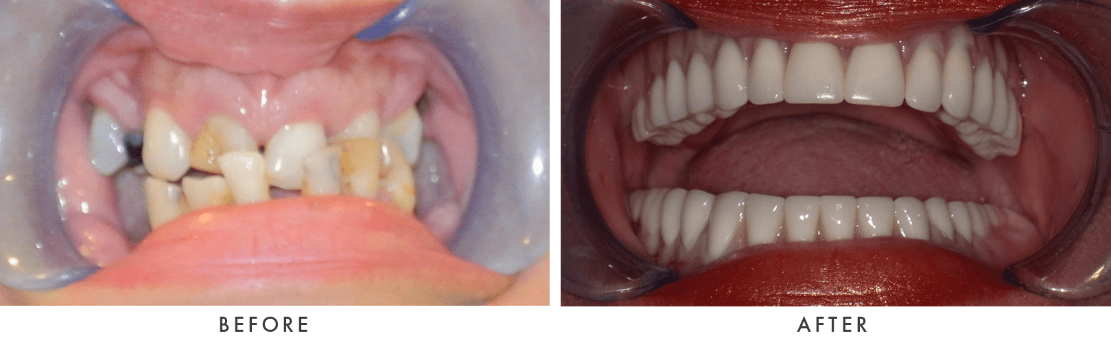Patient Before And After Photos