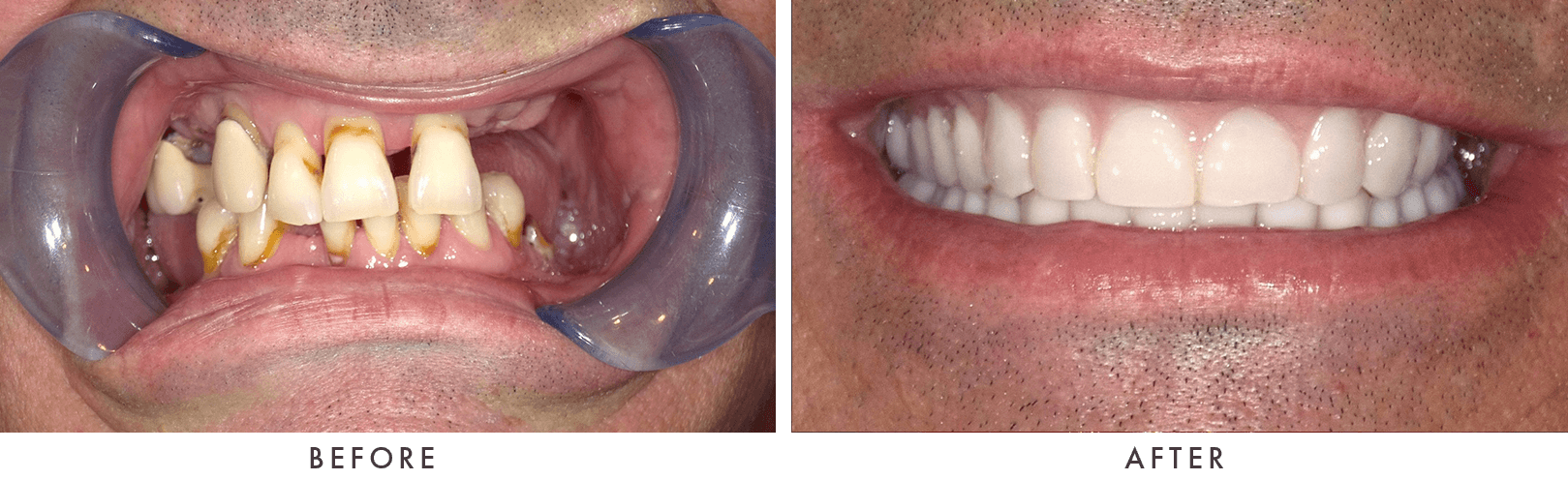 Patient Before And After Photos