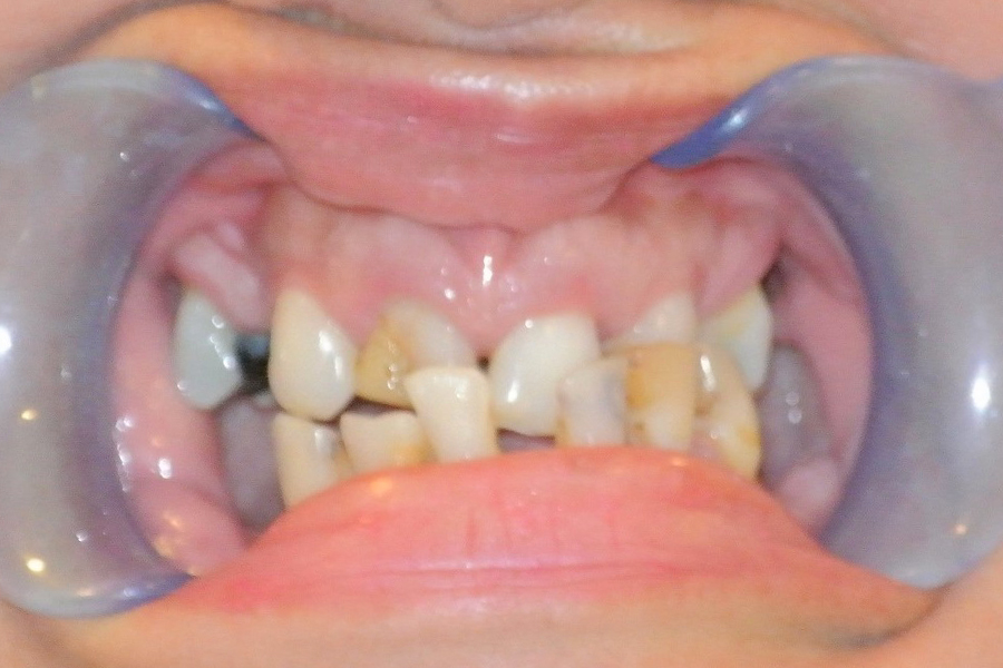 Before