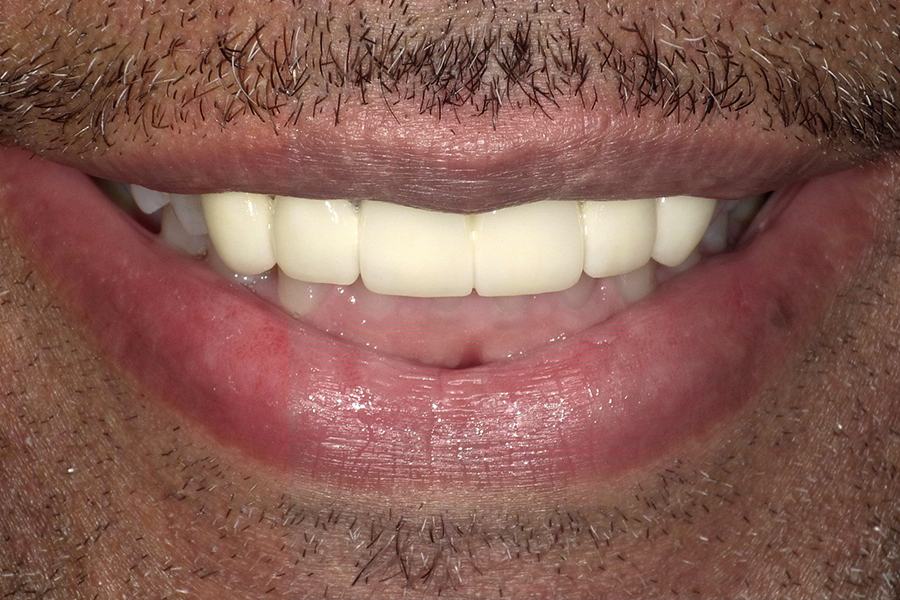 After