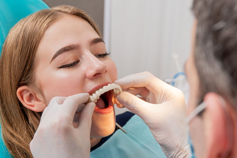 a close up picture of a doctor placing a full mouth dental prosthetic on the patients four dental implant posts for her All-On-4 dental implant treatment.