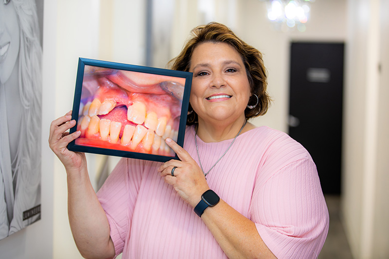 Suffering From Broken, Decayed, And Missing Teeth?