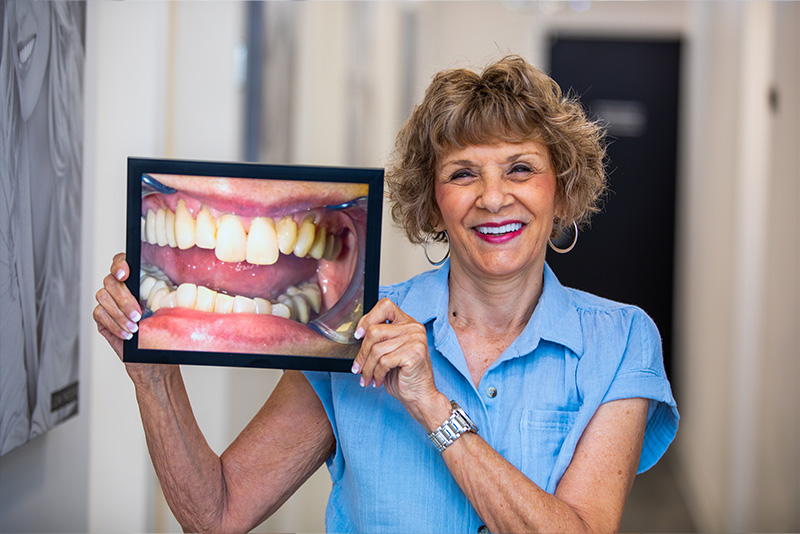 Total Smile Makeover