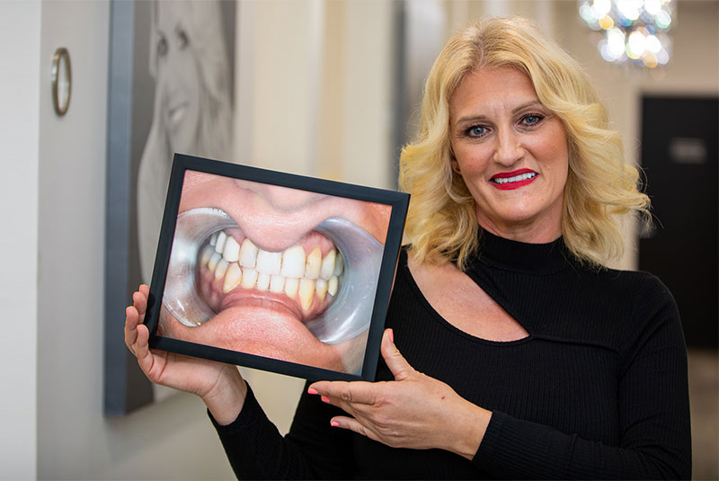 Dessi’s Story Dental Implants & Crowns