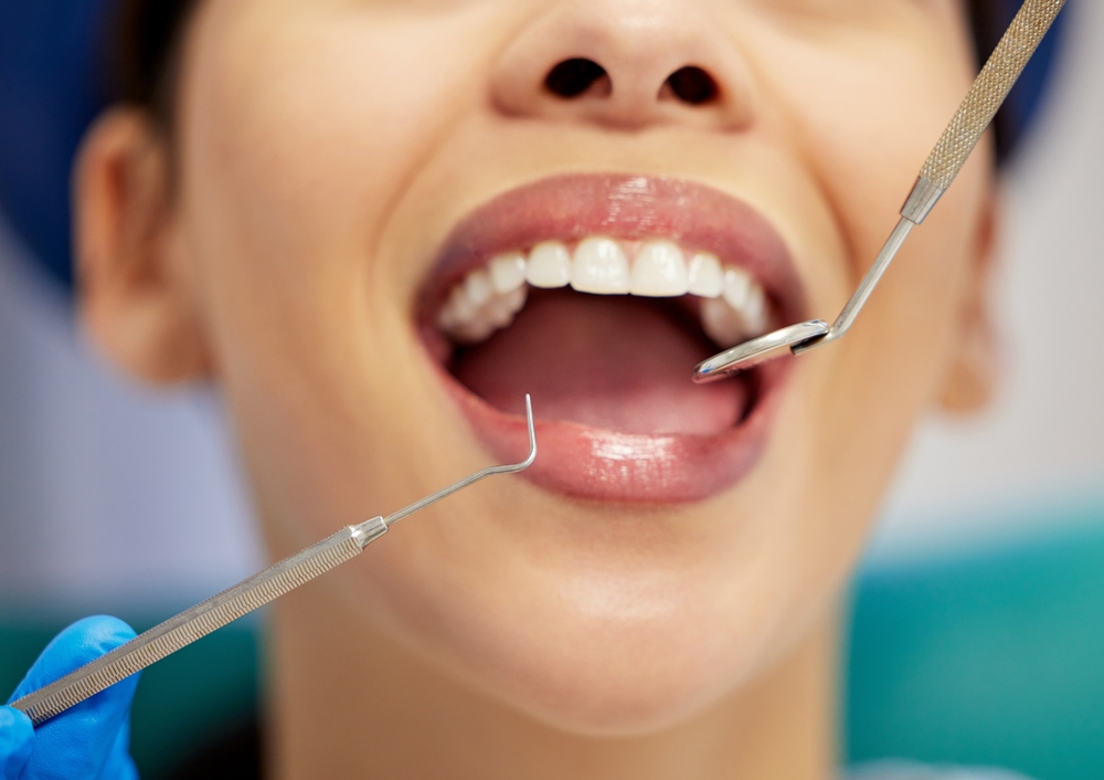 Find a Top Dentist In Seminole, FL For Your Dental Needs