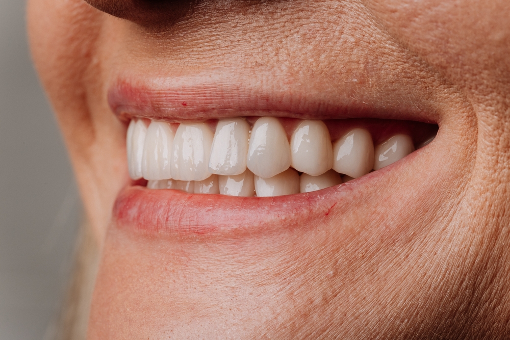 What Is That Implant? An Easy Guide To Dental Implants