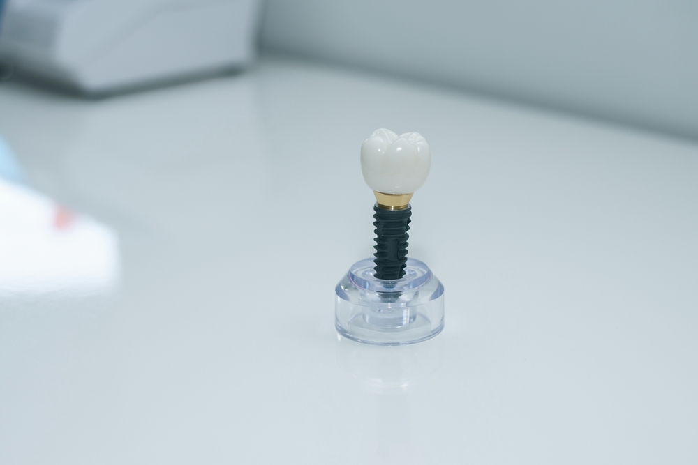 Understanding Dental Implants: Your Guide to Seminole Implants