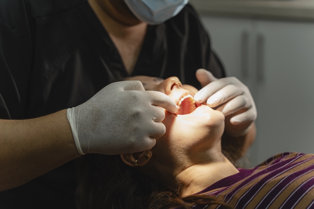 All You Need to Know About Dental Implants in Seminole